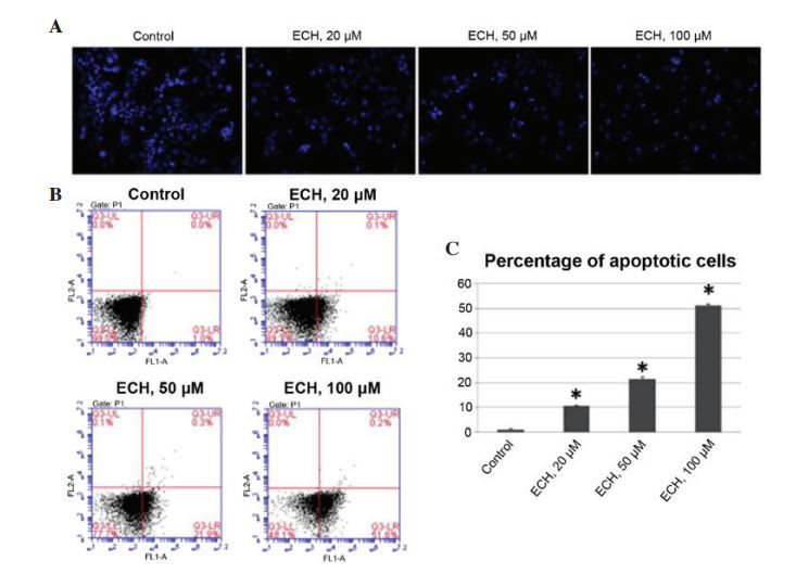 echinacoside treatment induces apoptosis in SW1990 cells.  echinacoside induces apoptosis in a dose-dependent manner as determined by Hoechst 33342 staining  (magnification, x400). (B)  echinacoside induces apoptosis in a dose‑dependent manner as determined by fluorescence‑activated cell sorting analyses. (C) Quantification  of apoptotic cells in (B). (* P<0.001, compared with the control). echinacoside.